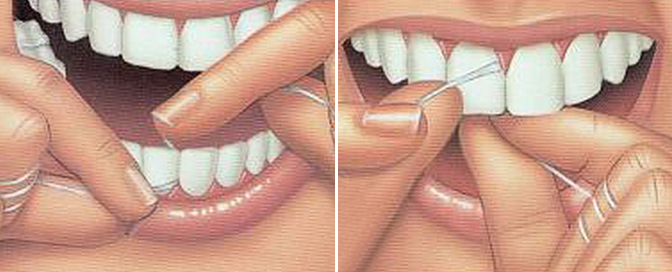 higijena zubi