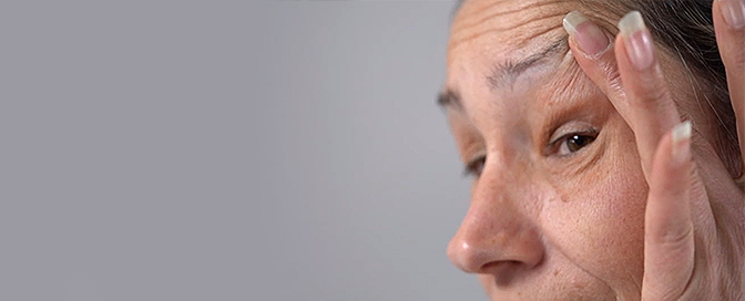 blepharoplasty