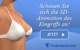 3D Animation Brustverkleinerung