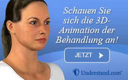 3D Animation Gesichtslifting