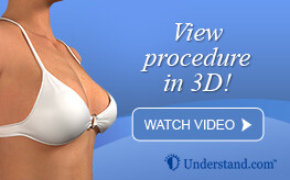 3D animation breast augmentation