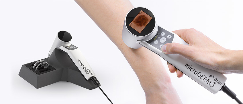 Digital dermatoscopy