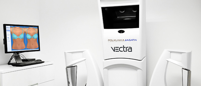 Još naprednije VECTRA 3D konzultacije