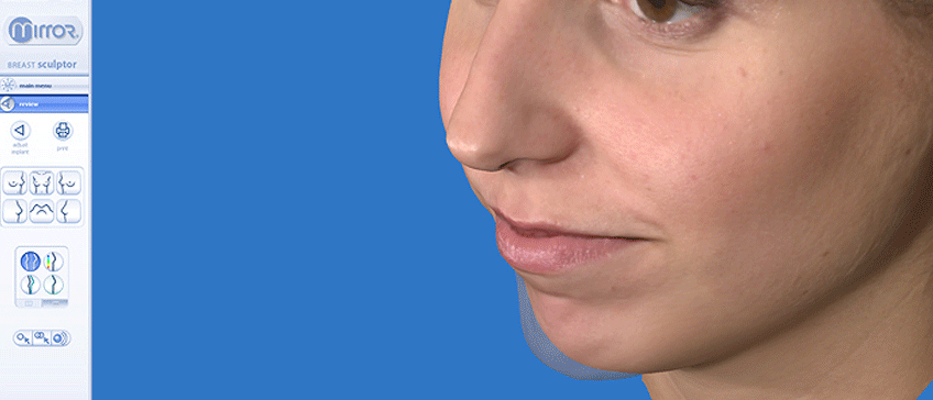Nose consultation with VECTRA 3D