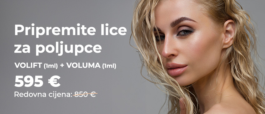 Web-novosti_Pripremite-lice-za-poljupce_848x364px