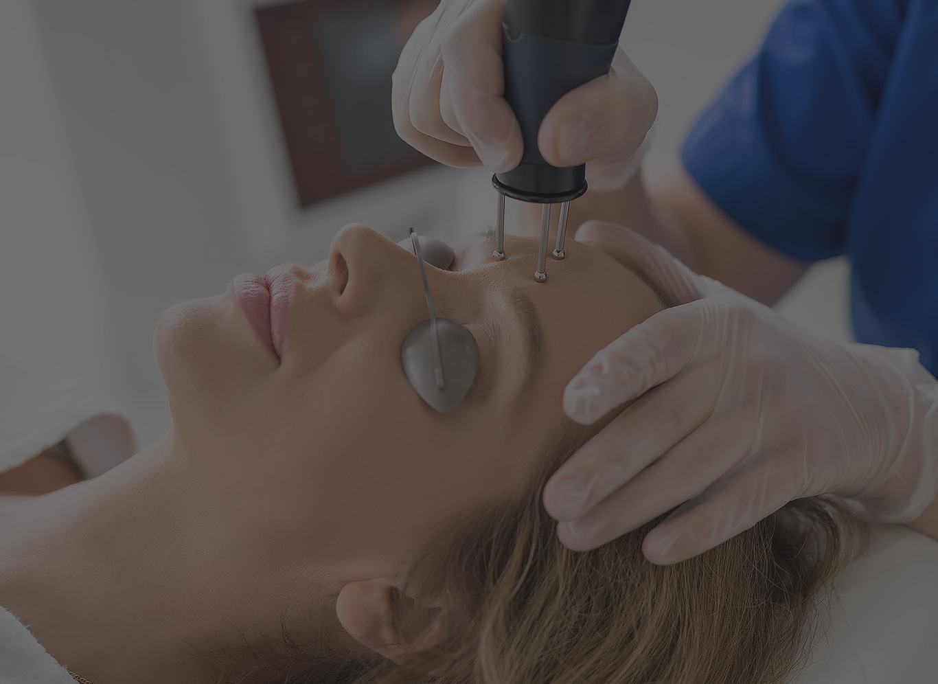 Frakcijski skin resurfacing - uklanjanje bora i ožiljaka od akni
