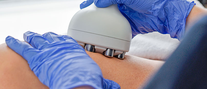 Pomlađivanje kože kroz tretman radiofrekvencije tijela